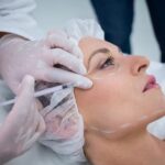 Mengenal Threadlift Treatment: Prosedur dan Manfaatnya