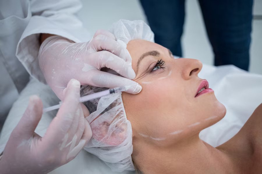 Mengenal Threadlift Treatment: Prosedur dan Manfaatnya